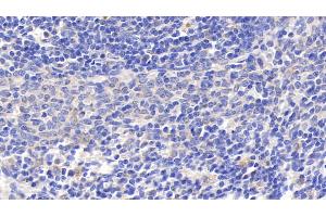 Detection of GRN in Rat Spleen Tissue using Polyclonal Antibody to Granulin (GRN) (Granulin anticorps  (AA 44-255))