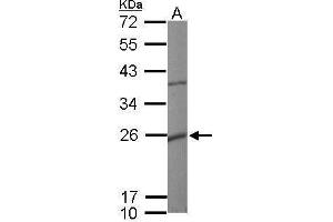 WB Image Sample (50 ug of whole cell lysate) A: mouse heart 12% SDS PAGE antibody diluted at 1:10000