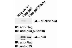 Western Blotting (WB) image for anti-Tumor Protein P53 (TP53) (pSer20) antibody (ABIN3201004) (p53 anticorps  (pSer20))
