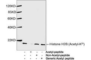 Western blot analysis of Hela cell lysates using 1 µg/mL Antibodies-Online Rabbit Anti-Histone H2B (Acetyl-K20) Polyclonal Antibody (ABIN398911) The signal was developed with IRDyeTM 800 Conjugated Goat Anti-Rabbit IgG. (Histone H2B anticorps  (Lys20))