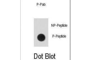 Dot Blot (DB) image for anti-Signal Transducer and Activator of Transcription 5A (STAT5A) (pSer726) antibody (ABIN5021402) (STAT5A anticorps  (pSer726))
