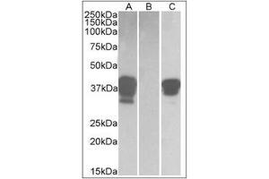 HEK293 lysate (10 µg protein in RIPA buffer) overexpressing Human POU2AF1 with DYKDDDDK tag probed with POU2AF1 Antibody  (1 µg/ml) in Lane A and probed with anti-DYKDDDDK Tag (1/3000) in Lane C. (POU2AF1 anticorps  (C-Term))