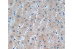 Used in DAB staining on fromalin fixed paraffin- embedded liver tissue