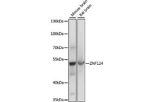 Western blot analysis of extracts of various cell lines, using ZNF124 antibody (ABIN7271452) at 1:1000 dilution. (ZNF124 anticorps  (AA 60-200))