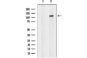 Western blot analysis of lysates from Hela cells, using KCNH1 Antibody.