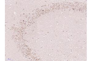 Paraformaldehyde-fixed, paraffin embedded Mouse brain Antigen retrieval by boiling in sodium citrate buffer (pH6.