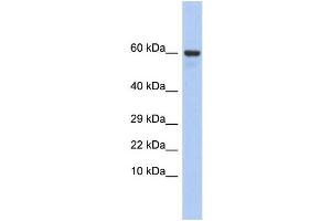 Western Blotting (WB) image for anti-Taxilin gamma (TXLNG) (N-Term) antibody (ABIN2785688) (Taxilin gamma (TXLNG) (N-Term) anticorps)