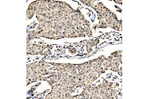 IHC analysis of SND1 using anti-SND1 antibody (ABIN7600527).