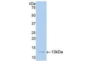 Detection of Recombinant uPAR, Human using Polyclonal Antibody to Plasminogen Activator, Urokinase Receptor (uPAR)
