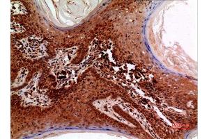 Immunohistochemistry (IHC) analysis of paraffin-embedded Human Skin, antibody was diluted at 1:100. (RFC1 anticorps  (C-Term))