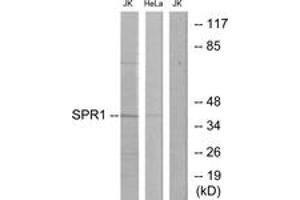 Western blot analysis of extracts from Jurkat/HeLa cells, using SPR1 Antibody.
