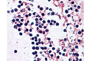 Anti-NLRP3 antibody IHC of human peripheral blood leukocytes. (NLRP3 anticorps  (AA 82-93))