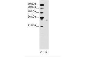 Image no. 2 for anti-Solute Carrier Family 22 (Organic Cation Transporter), Member 7 (SLC22A7) (C-Term) antibody (ABIN6736645) (SLC22A7 anticorps  (C-Term))