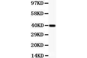 Anti-MCL1 Picoband antibody,  All lanes: Anti MCL1  at 0. (MCL-1 anticorps  (AA 1-350))