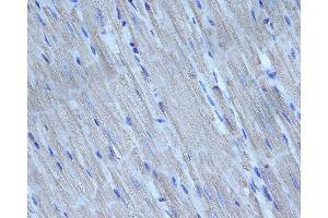 ABIN6276298 at 1/200 staining rat heart tissue sections by IHC-P.