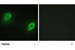 Immunofluorescence analysis of HeLa cells, using AKAP5 polyclonal antibody . (AKAP5 anticorps  (N-Term))