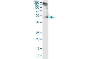 RCN1 monoclonal antibody (M01), clone 1F8-E4. (RCN1 anticorps  (AA 31-331))