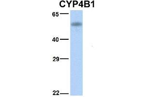 Host:  Rabbit  Target Name:  CYP4B1  Sample Type:  Human Fetal Liver  Antibody Dilution:  1.