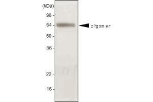 Western blot analysis. (ADIPOQ anticorps  (AA 15-244))
