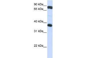 WB Suggested Anti-GP6 Antibody Titration:  0. (GP6 anticorps  (Middle Region))