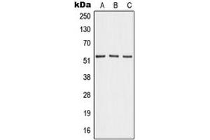 Western blot analysis of Angiopoietin-4 expression in HEK293T (A), mouse lung (B), PC12 (C) whole cell lysates. (Angiopoietin 4 anticorps  (Center))