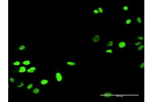 Immunofluorescence of purified MaxPab antibody to RECQL on HeLa cell.