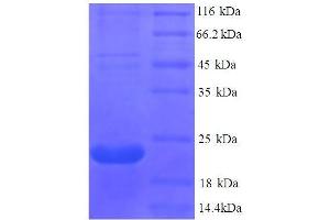 Tumor Necrosis Factor Receptor Superfamily, Member 11a, NFKB Activator (TNFRSF11A) (AA 28-202) protein (His tag)