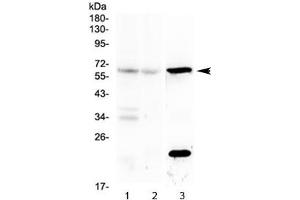 Western blot testing of mouse 1) brain, 2) liver and 3) kidney lysate with Il23r antibody at 0. (IL23R anticorps)