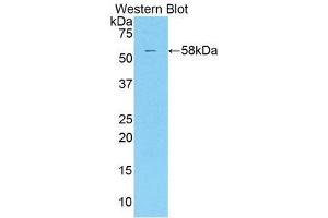 Western Blotting (WB) image for anti-Killer Cell Immunoglobulin-Like Receptor 2DS2 (KIR2DS2) (AA 22-304) antibody (ABIN1859539)