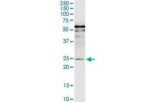 MIS12 monoclonal antibody (M01), clone 1G3. (MIS12 anticorps  (AA 1-205))
