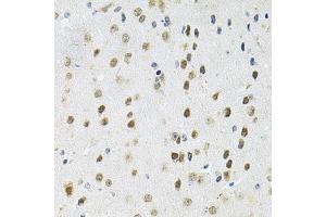 Immunohistochemistry of paraffin-embedded mouse brain using PPP1CA antibody. (PPP1CA anticorps)