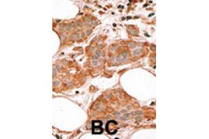 Immunohistochemistry (IHC) image for anti-BCL2-Like 14 (Apoptosis Facilitator) (BCL2L14) (BH3 Domain) antibody (ABIN2997105)
