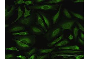 Immunofluorescence of purified MaxPab antibody to NARS on HeLa cell. (NARS anticorps  (AA 1-548))