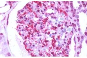 Human Kidney: Formalin-Fixed, Paraffin-Embedded (FFPE)