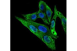Immunocytochemistry (ICC) image for anti-rho GDP Dissociation Inhibitor (GDI) alpha (ARHGDIA) (AA 1-204) antibody (ABIN1844919)