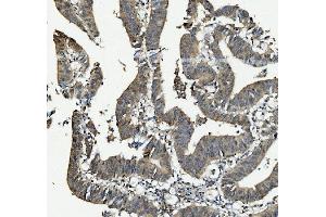 IHC analysis of ANAPC2 using anti-ANAPC2 antibody (ABIN7601930). (ANAPC2 anticorps  (AA 51-272))