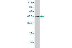 Western Blot detection against Immunogen (45.