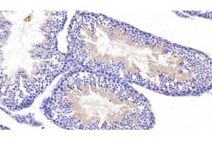 Detection of HDAC6 in Mouse Testis Tissue using Polyclonal Antibody to Histone Deacetylase 6 (HDAC6)