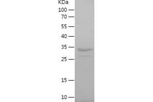 Western Blotting (WB) image for Solute Carrier Family 22 Member 6 (SLC22A6) (AA 460-563) protein (His-IF2DI Tag) (ABIN7125159)