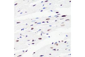 Immunohistochemistry of paraffin-embedded mouse heart using H3K36me2 antibody.