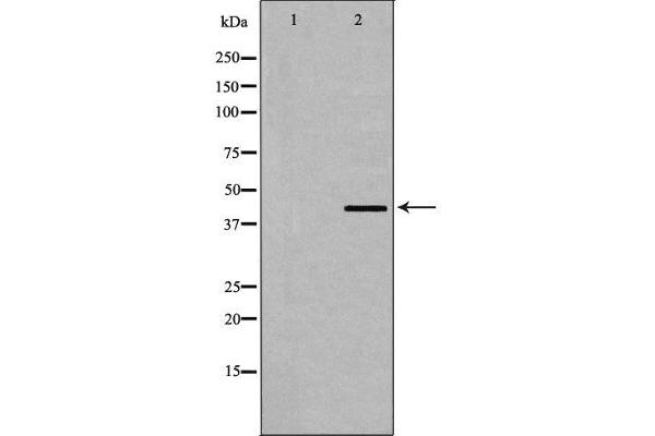 Dematin anticorps  (C-Term)