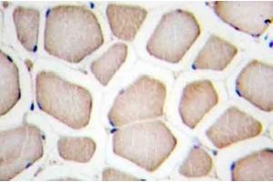 Image no. 1 for anti-CASP8 and FADD-Like Apoptosis Regulator (CFLAR) antibody (ABIN272307) (FLIP anticorps)