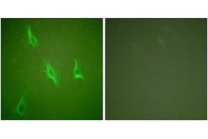 Immunofluorescence analysis of HeLa cells, using Caspase 10 Antibody. (Caspase 10 anticorps  (AA 430-479))