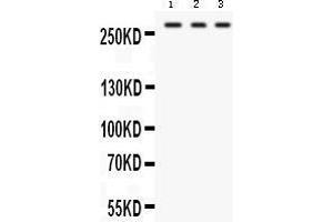 Western blot analysis of FASN expression in HEPG2 whole cell lysates (lane 1), U87 whole cell lysates (lane 2) and RAJI whole cell lysates (lane 3). (Fatty Acid Synthase anticorps  (AA 1-226))