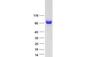 Validation with Western Blot