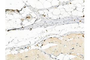 Phospho-PFKFB3 (Ser461) Antibody at 1/100 staining Rat skin tissue by IHC-P. (PFKFB3 anticorps  (pSer461))