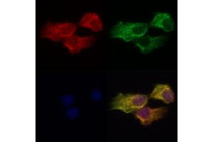 ABIN7093839 and ABIN7097882 staining Hela cells by IF/ICC.