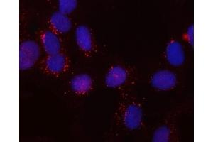 IF analysis of SNX6 using anti-SNX6 antibody (ABIN7599362).