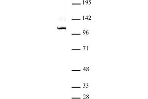 GLI1 antibody (pAb) tested by Western blot. (GLI1 anticorps  (C-Term))
