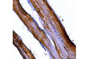 IHC analysis of Nedd4 using anti-Nedd4 antibody (ABIN7602341).